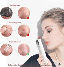 Load image into Gallery viewer, Blackhead Remover, Vacuum Face Cleansing Appliances with Hot Compress, USB Rechargeable with 5 Replaceable Heads pattanaustralia
