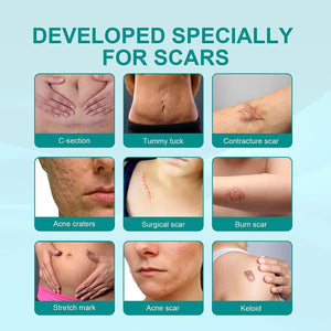 Fivfivgo Scarremove Advanced Scar Spray, 2023 New Scar Remove Spray for All Types of Scars, Surgical Scars and Stretch Marks, Especially Acne Scars (Size : 3Pc)