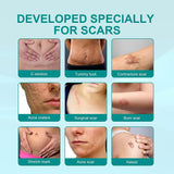 Fivfivgo Scarremove Advanced Scar Spray, 2023 New Scar Remove Spray for All Types of Scars, Surgical Scars and Stretch Marks, Especially Acne Scars (Size : 3Pc)