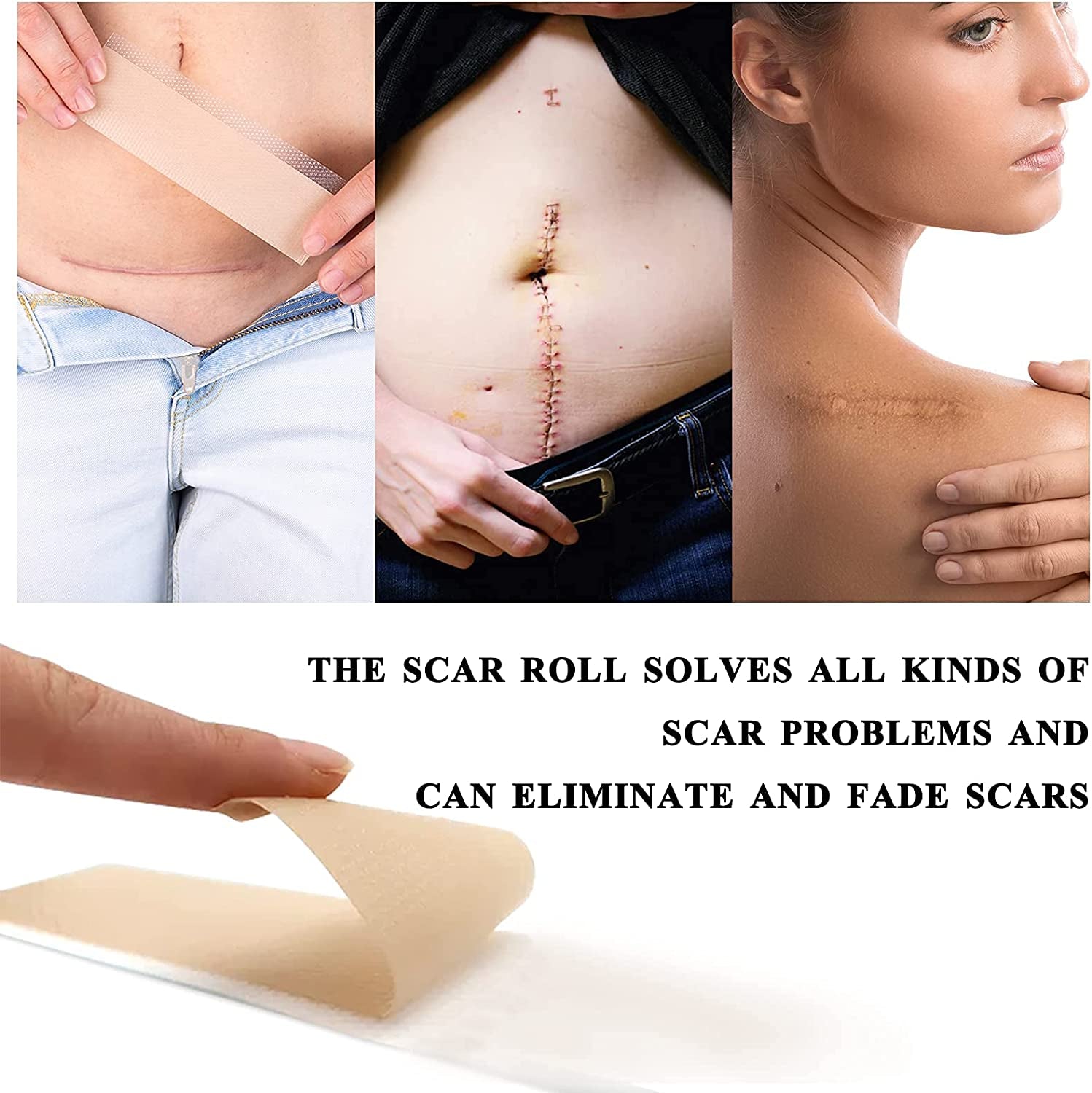 Silicone Scar Sheets,Scar Removal,Silicone Scar Tape Roll for C-Section,Professional Painless Silicone Keloid Scars from Surgery, Burn, Acne Et (1.6” X 60”Roll-1.5M)
