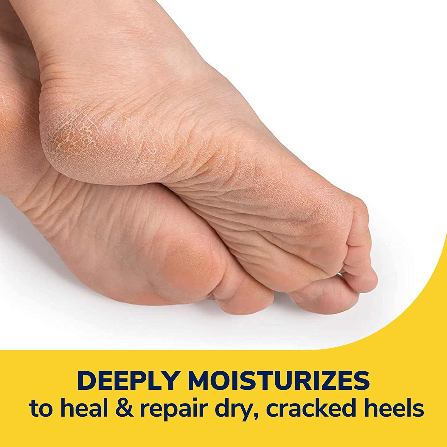 Dr. Scholl’S® Severe Cracked Heel Balm