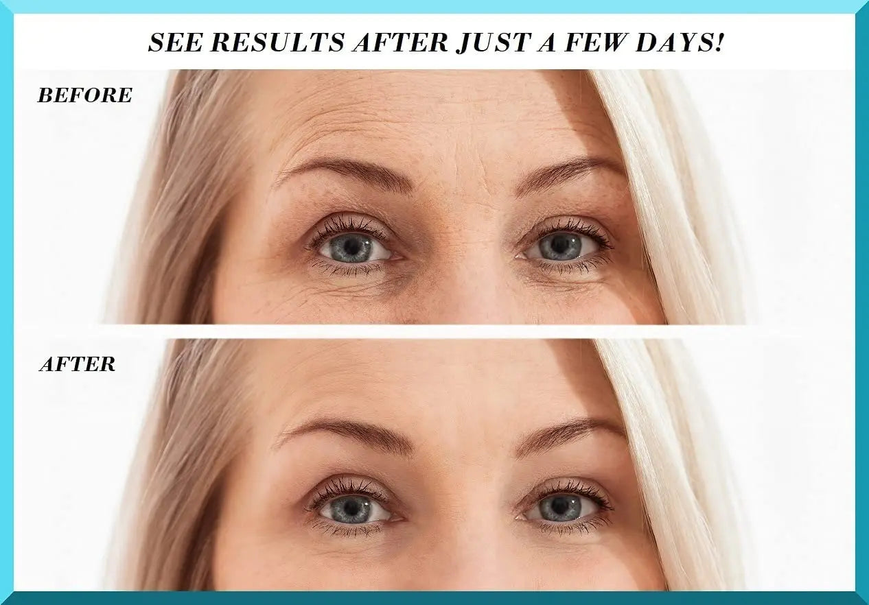 Elsa Anti Aging Silicone Pad Kit Reusable and Medical Grade Décolleté Pattan Australia