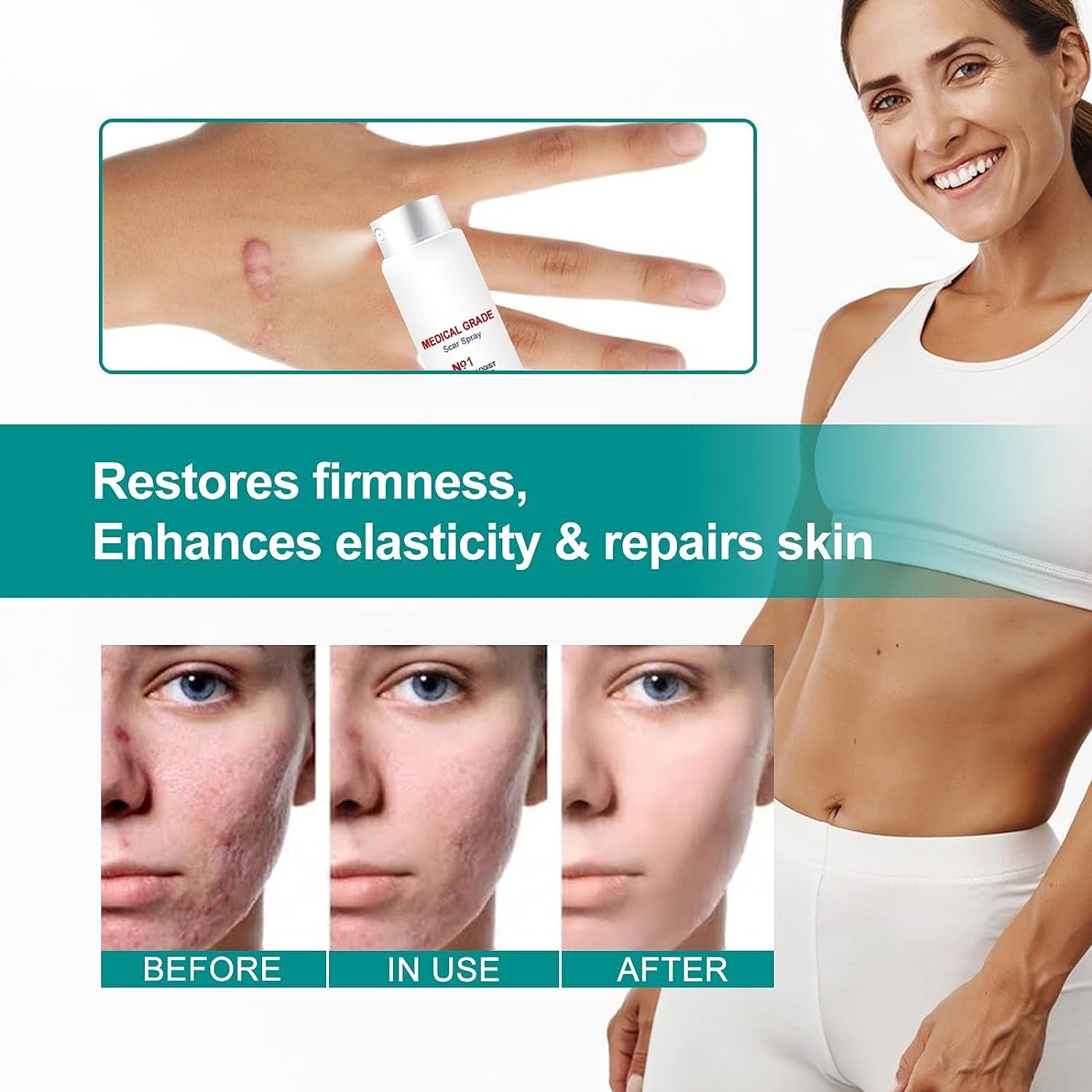 Fivfivgo Scarremove Advanced Scar Spray, 2023 New Scar Remove Spray for All Types of Scars, Surgical Scars and Stretch Marks, Especially Acne Scars (Size : 3Pc)