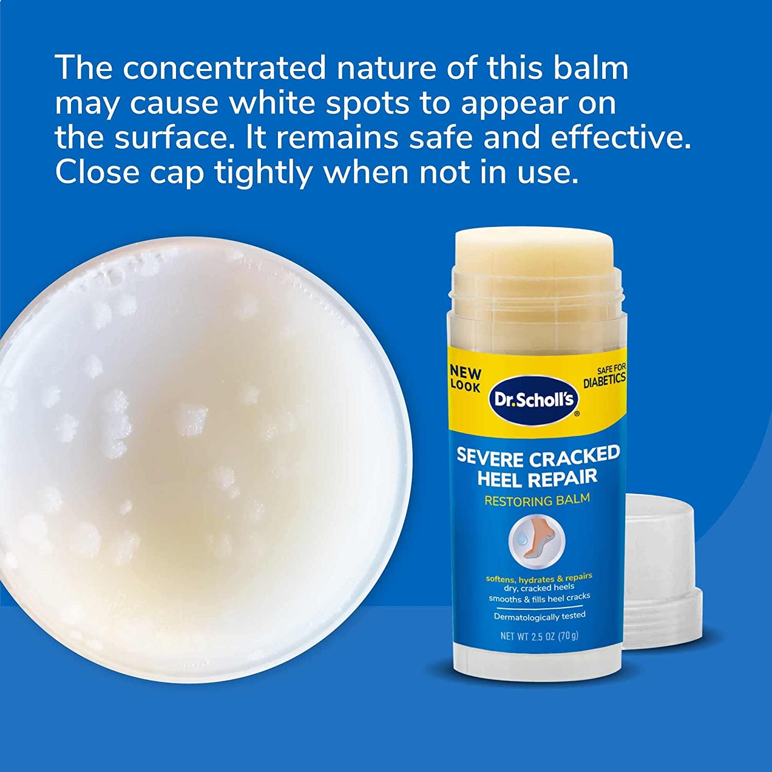 Dr. Scholl’S® Severe Cracked Heel Balm